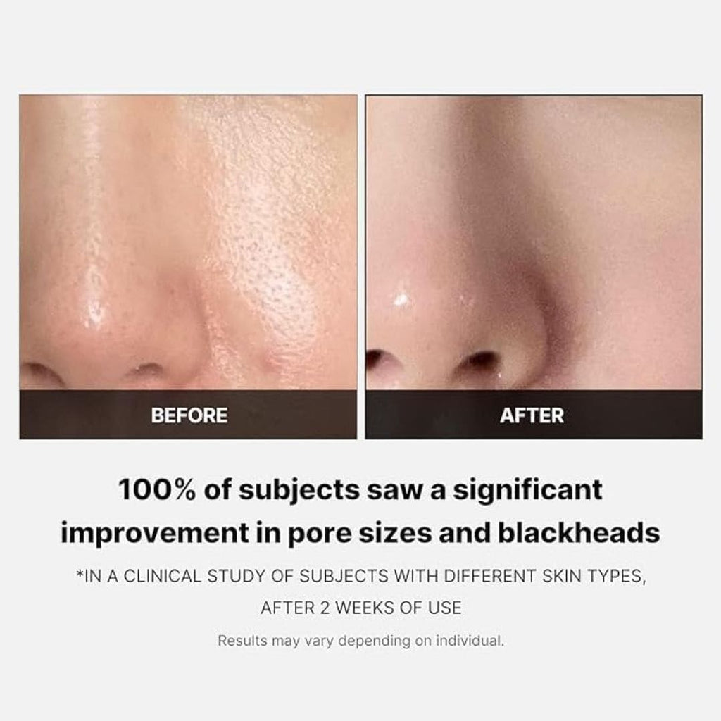 (3 Units) Zero Pore Pad 2.0 Bundle